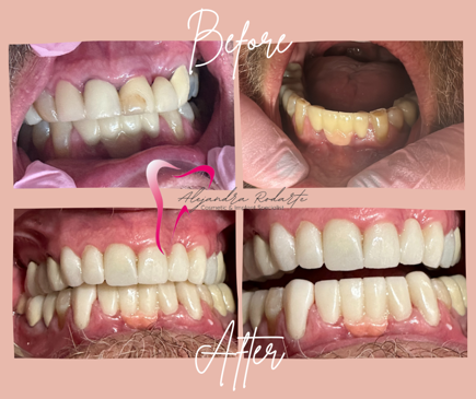 Slider image (6) Dr. Alejandra Rodarte Cosmetic & Implant Specialist